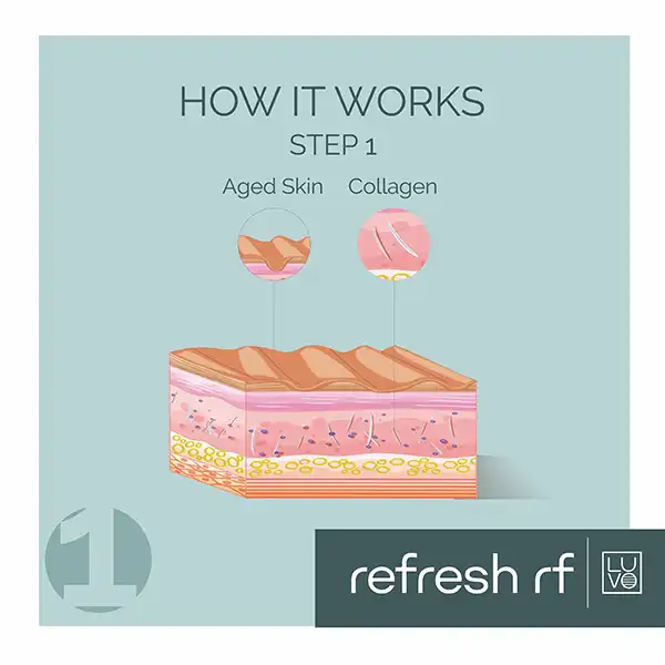 Refresh Rf Step 1