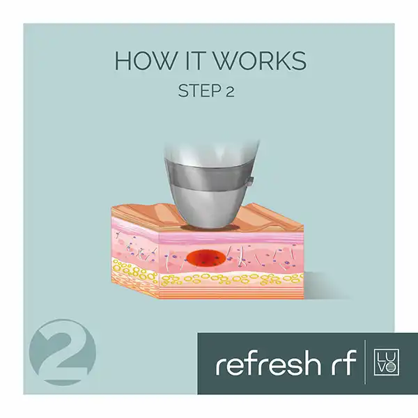 Refresh Rf Step 2