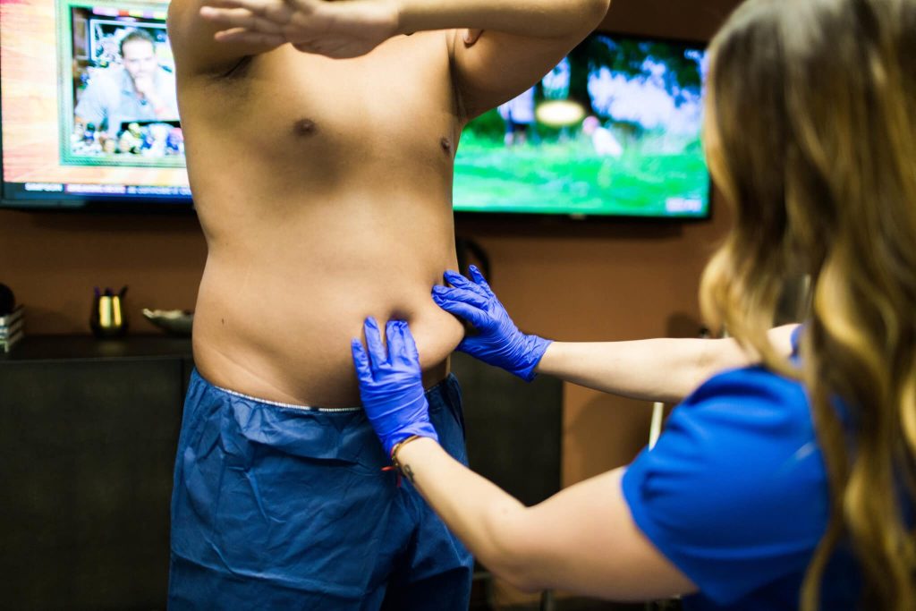 A technician pinches the abdominal area of a patient during a CoolSculpting consultation.