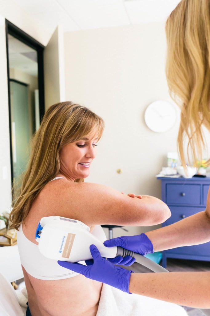 Coolsculpting Upper Arm Treatment