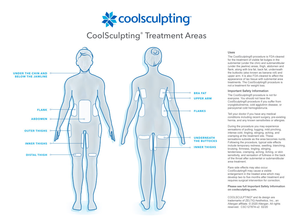 CoolSculpting Treatment area illustration