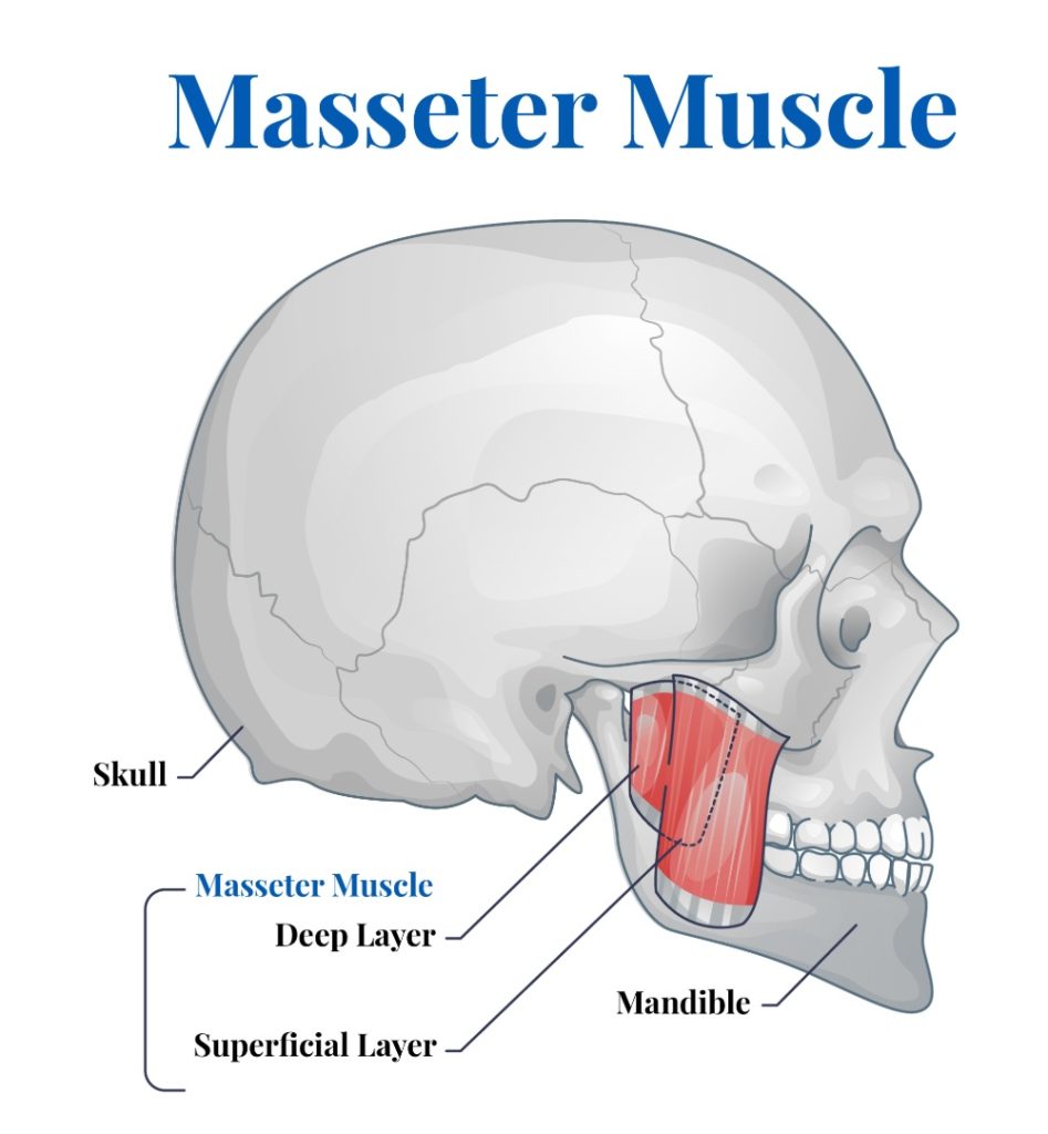 Anatomical illustration of the masseter muscle, highlighting its deep and superficial layers along the mandible and skull.