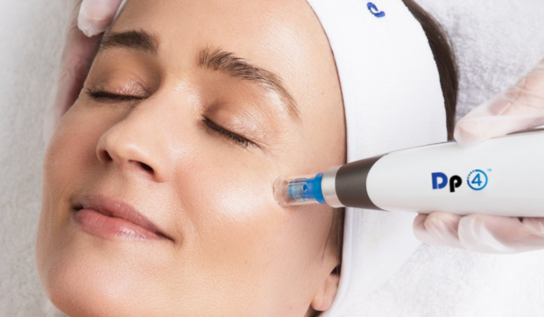 DP4 Microneedling In Calgary - Beacon Dermatology
